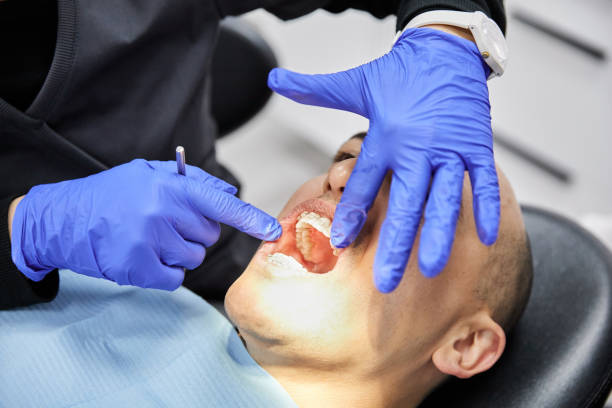Best Emergency Broken Tooth Repair in Union Springs, AL